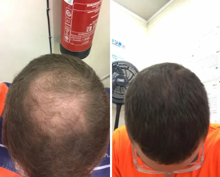 After 4.5 Months