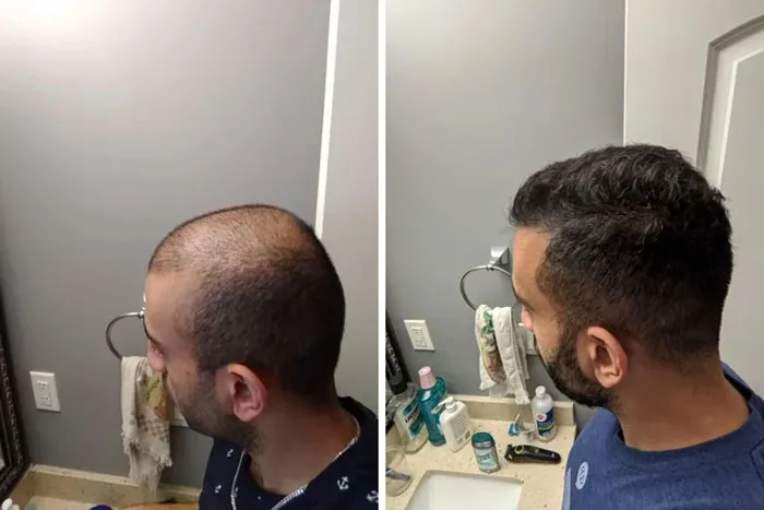 After 25 Months