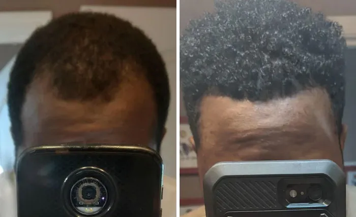 After 3 Years
