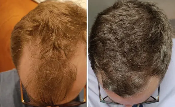After 22 Months