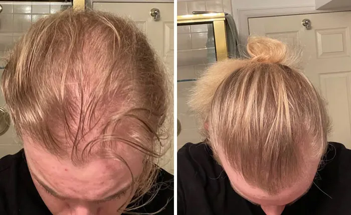 After 2.5 Years