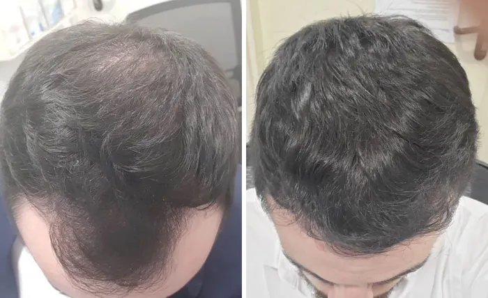 After 2 Years