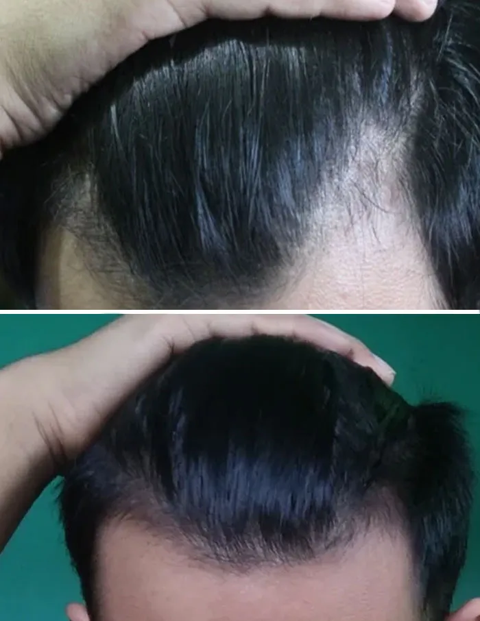 After 10 Months