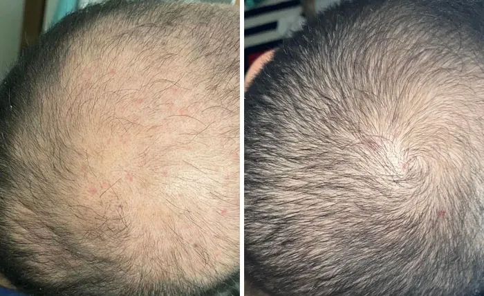 After 3 Months
