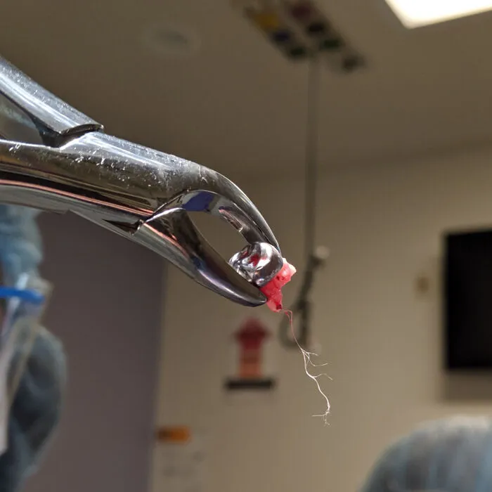 Extracted Tooth With Intact Nerve Root - Super Rare