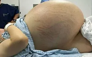 50 Amazing Medical Cases That Are Interesting And Bizarre At The Same Time