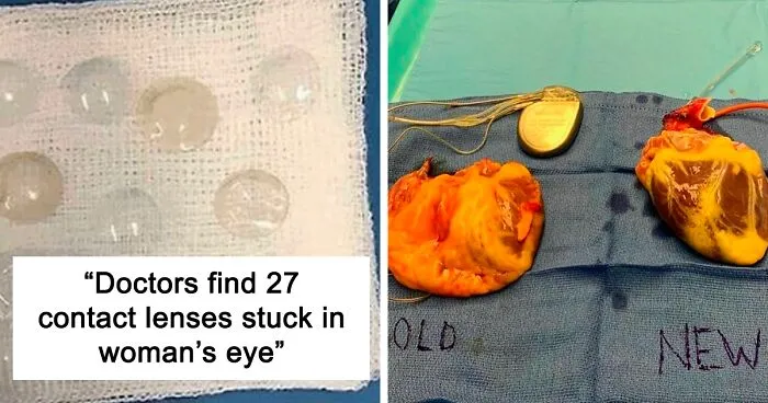 50 Amazing Medical Cases That Are Interesting And Bizarre At The Same Time