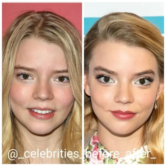 Anya Taylor-Joy