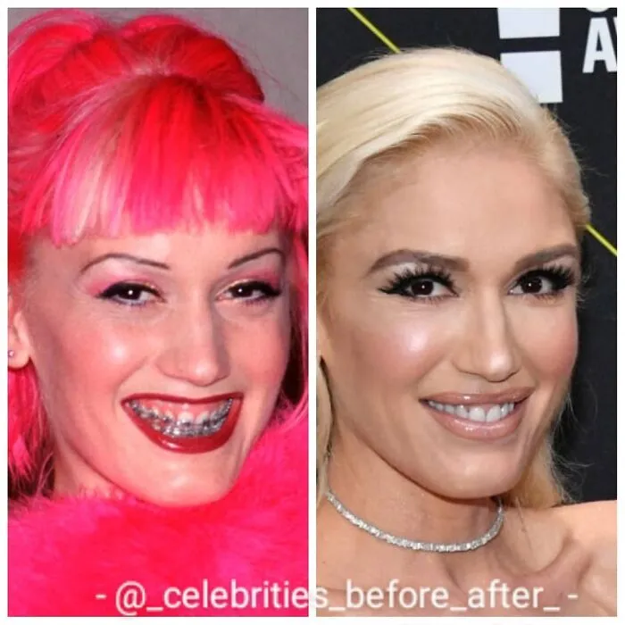 Gwen Stefani