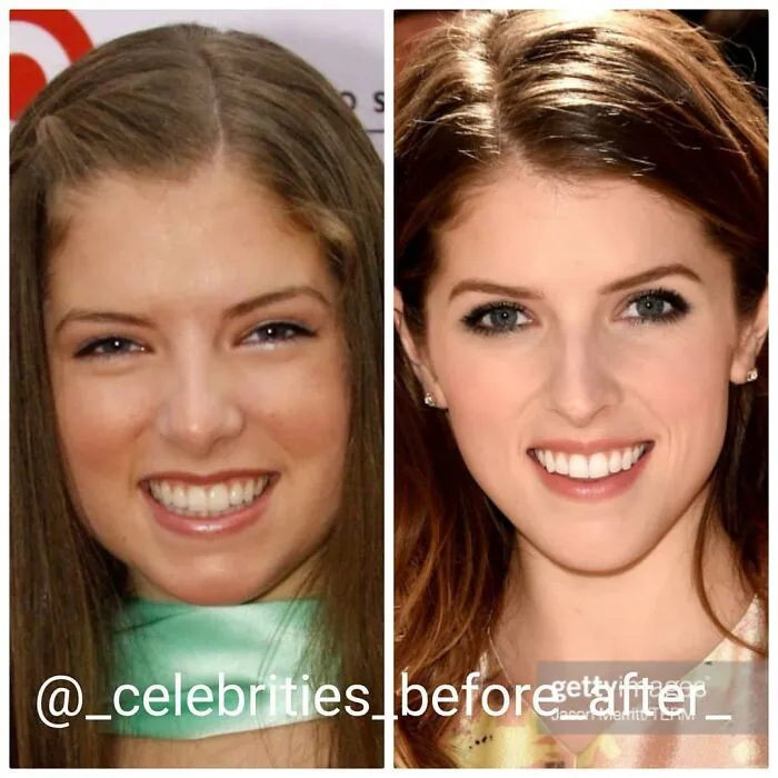 Anna Kendrick