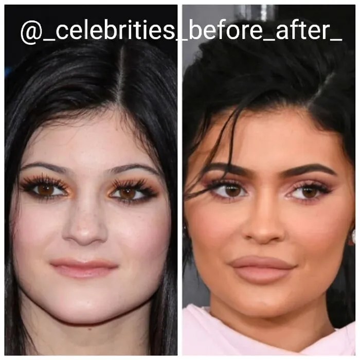 Kylie Jenner