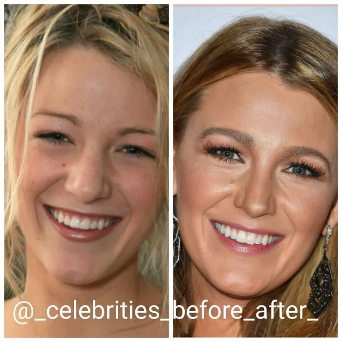Blake Lively