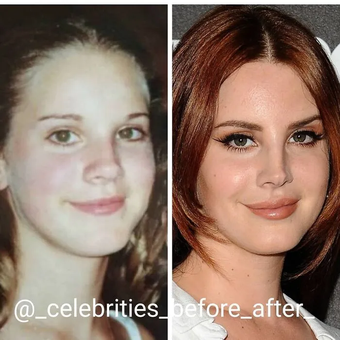 Lana Del Rey