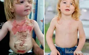 50 Amazing Medical Cases That Are Interesting And Bizarre At The Same Time