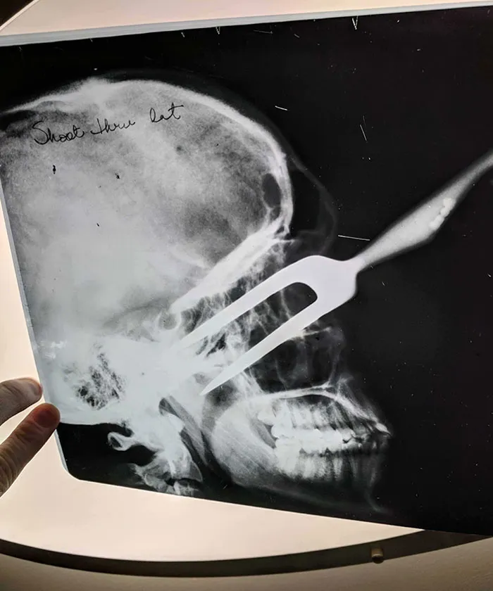Mi amigo compró una casa y encontró unas radiografías en una caja vieja