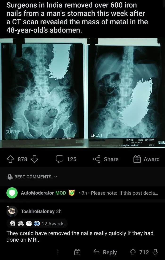 Cursed Mri