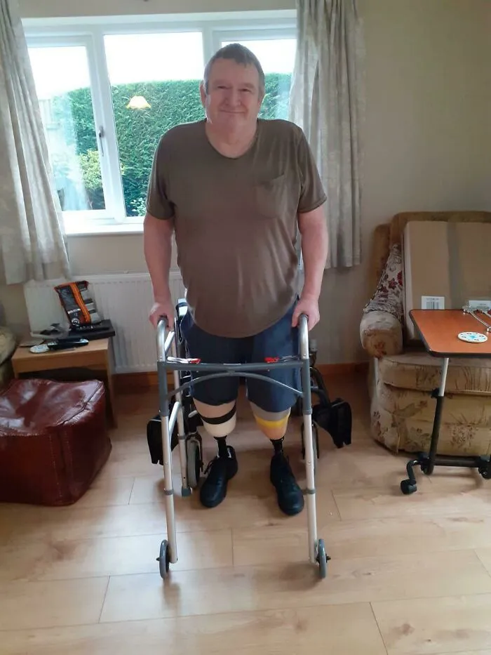 I Was Sent This Just Before Christmas, This Is The First Time My Dad Has Stood Up Without Having Someone To Help Him Since The Amputation And I’m So Proud Of Him