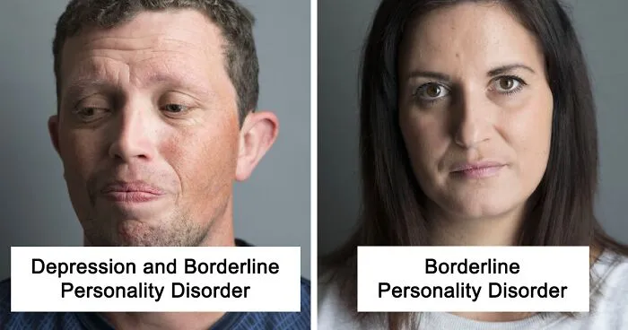 Faces And Stories Of People With Mental Or Physical Illnesses: 16 Portraits I Took