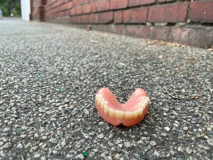 Not My Teeth But Someone’s Not Eating Solids Today