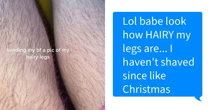 Woman Sends Her Boyfriend A Pic Of Her Hairy Legs To Have A Laugh, Doesn't Expect He Would Respond By Shaming Her