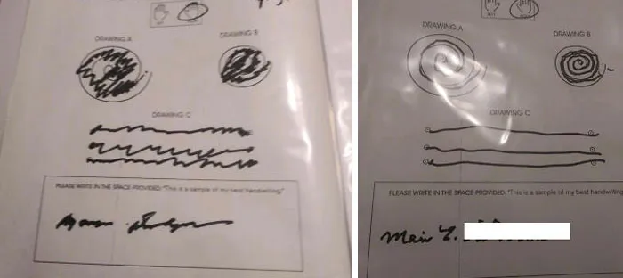 My 90-Year-Old Grandmother's Handwriting Before And After Her Focused Ultrasound Essential Tremor Treatment