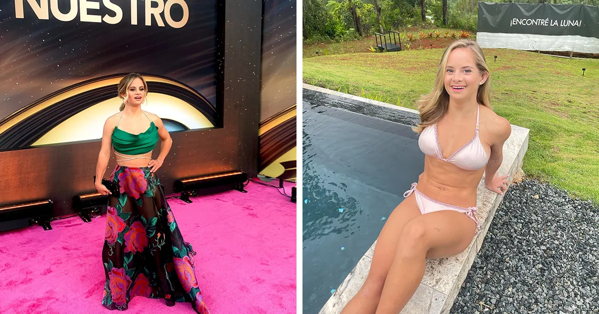 Esta modelo de 24 años cumple su sueño de convertirse en la primera modelo de Victoria's Secret con síndrome de Down