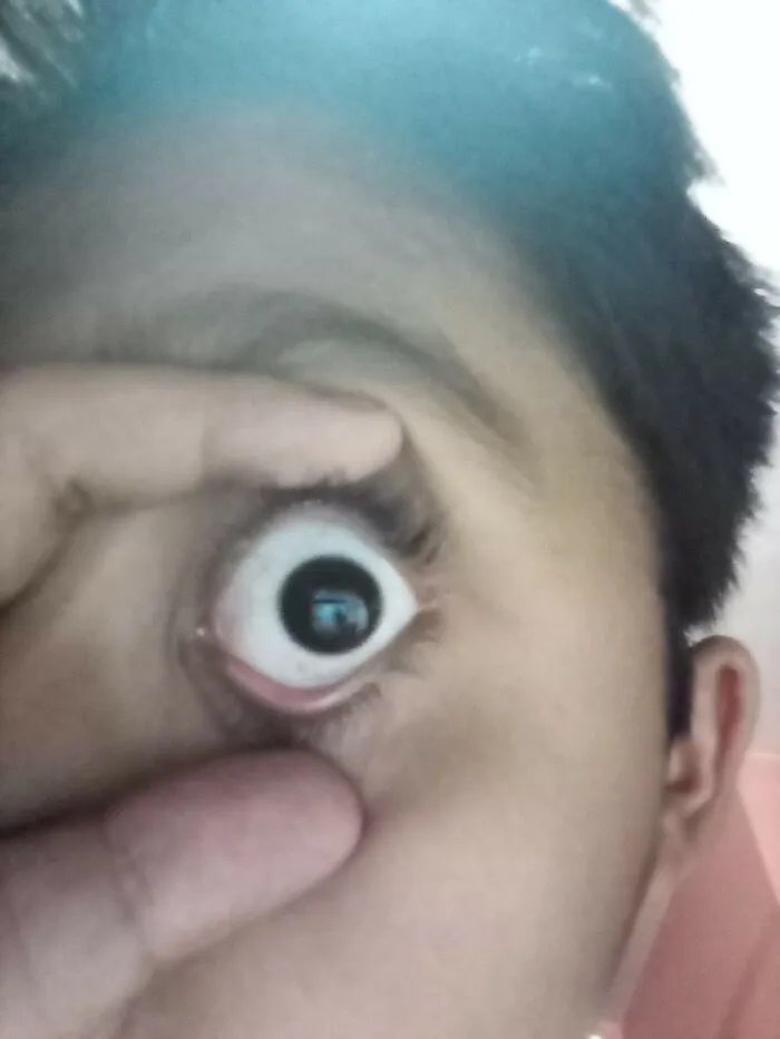 Black Eyes