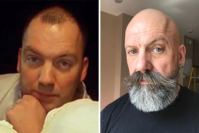 What A Difference A Beard Makes