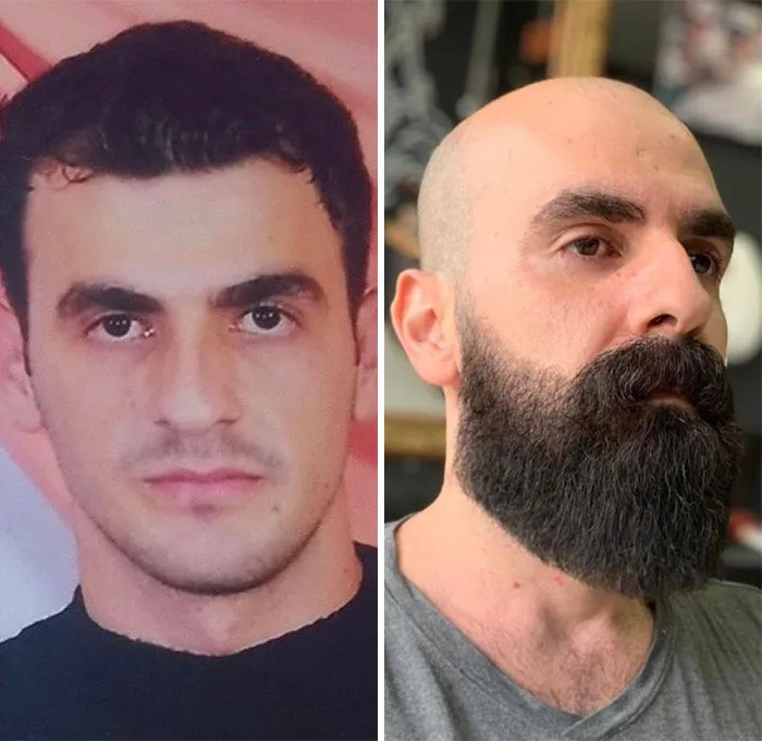 El tiempo invirtió mi pelo