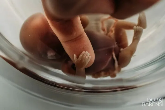 Honorable Mention: "Touch Of Love" By Dora Barens, Netherlands