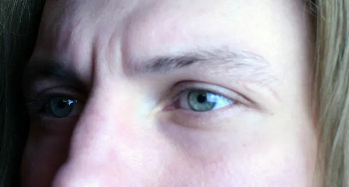 "My Eyes!" That Dude From Spongebob