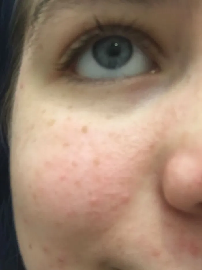 Blue Eyes!