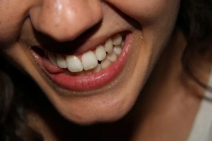 Dental Care