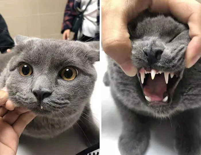 Supernumerary Teeth