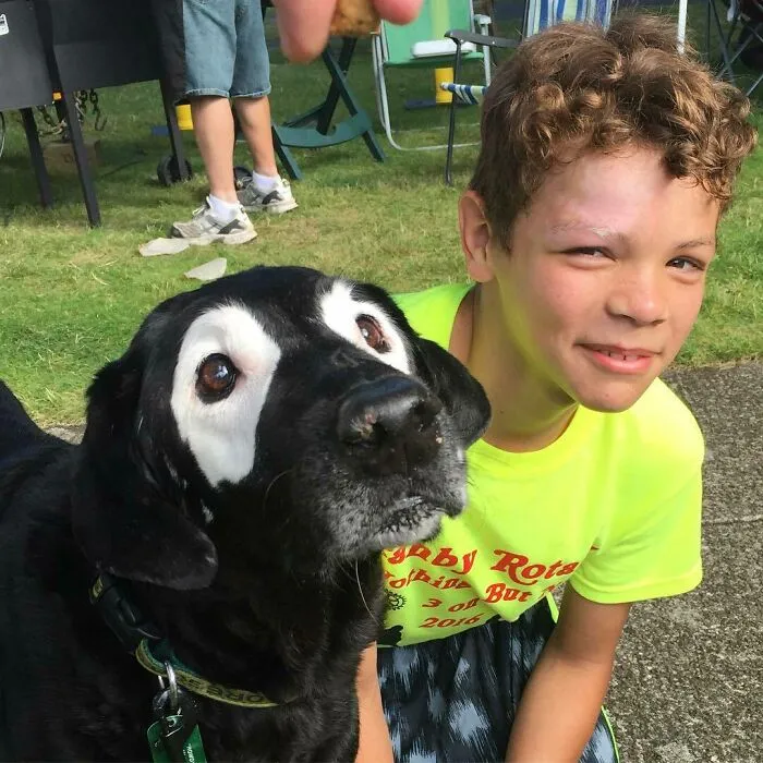 Rowdy Met A New Friend Today. This Is Marcus And He Has Such A Great Attitude About His Vitiligo. He Thinks It's Pretty Cool