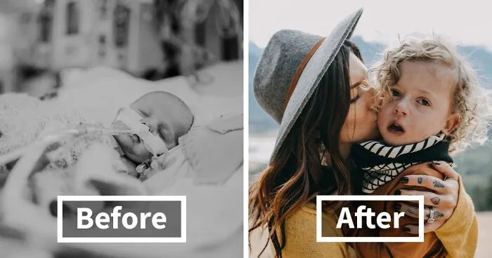 My Son Had Three Open Heart Surgeries Before The Age Of 5, And Here's How Our Journey Went