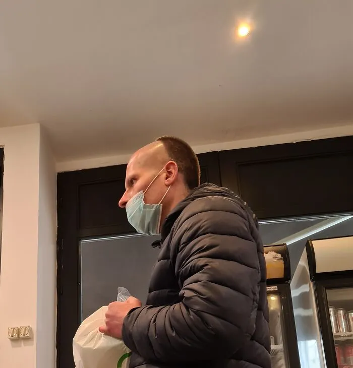 This Vertical Half-Bald Cut