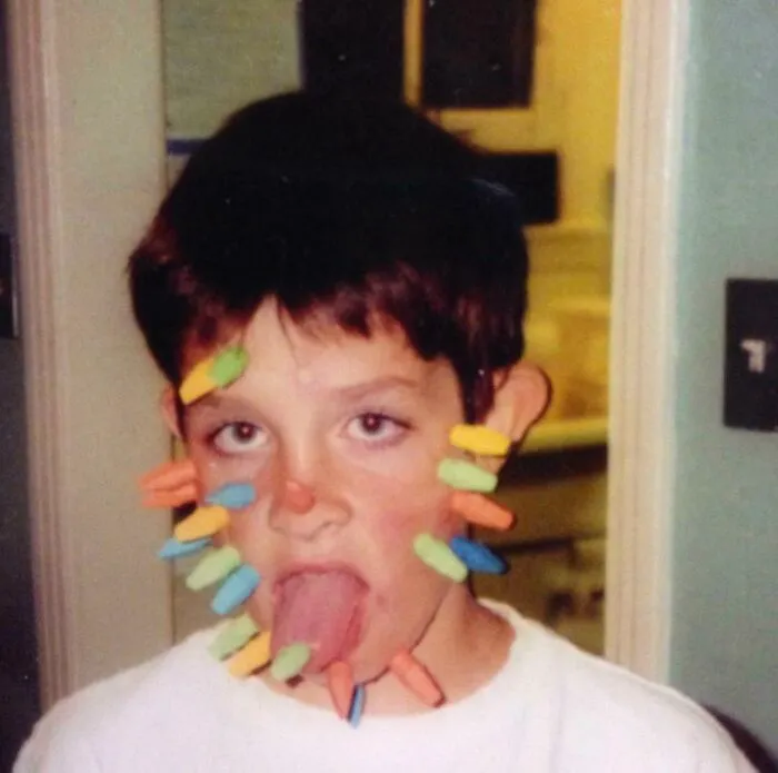 In 4th Grade I Stuck Erasers All Over My Face, Which Left Red Welts Everywhere. My Mom Had To Send Me To School With A Note Letting Them Know I Didn’t Have Measles And I Was Just An Idiot