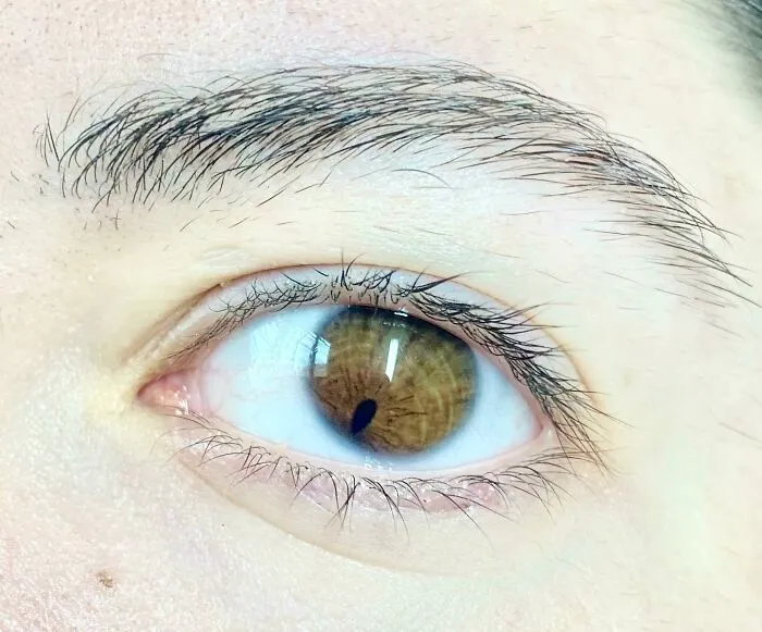 Sometimes People Stop In The Middle Of A Conversation To Stare At My Eye. Wonder Why