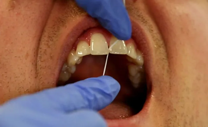 El hilo dental. No el baile. Sino en los dientes