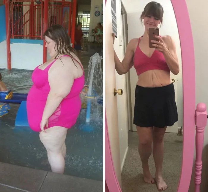 425 Lbs To 150 Lbs. 3 Years Between Pictures. Summer Always Makes Me Think About How Far I’ve Come