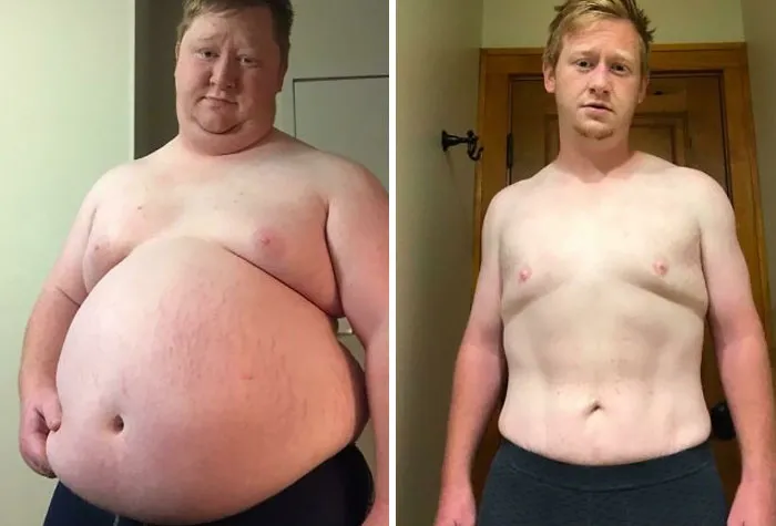 Lost 200 Pounds In A Year. Just Did The 20:4 Fast And Walked ~5km Every Day (360 Lbs To 160 Lbs)