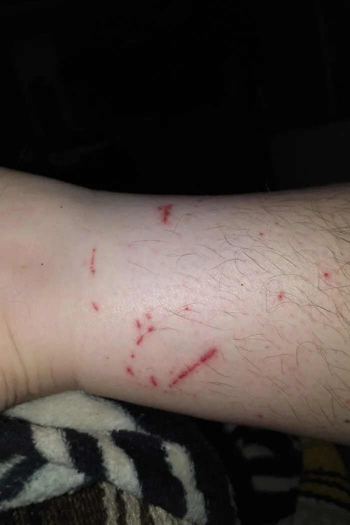 Anyone For A Snack Of Leg?