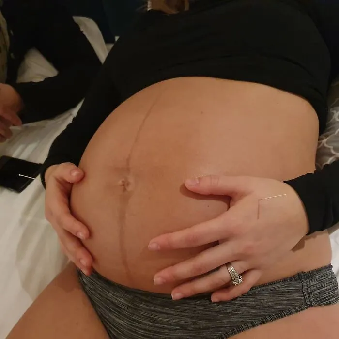 30 Mothers Are Sharing Realistic Pictures Of Baby Bumps And Pregnant Bodies To Fight Toxic Standards