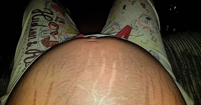 25 Madres comparten fotos realistas de sus barrigas y cuerpos de embarazada para luchar contra los estándares tóxicos