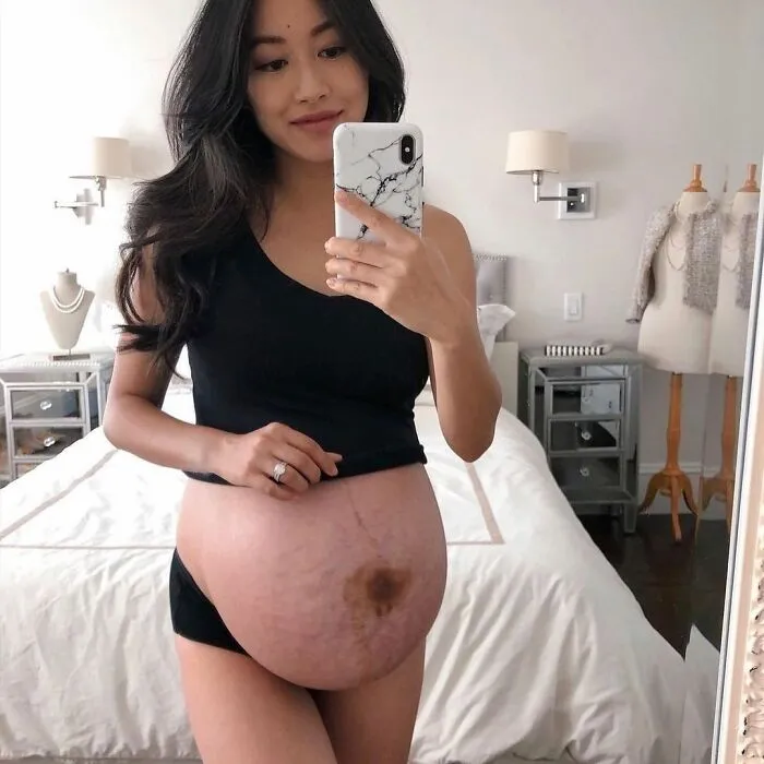 25 Madres comparten fotos realistas de sus barrigas y cuerpos de embarazada para luchar contra los estándares tóxicos