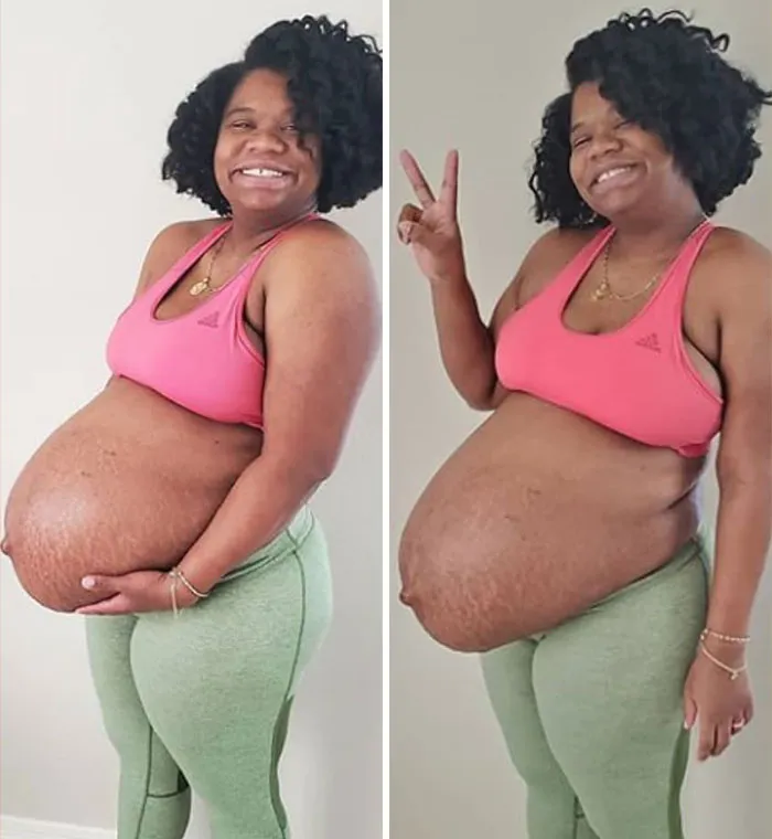 25 Madres comparten fotos realistas de sus barrigas y cuerpos de embarazada para luchar contra los estándares tóxicos