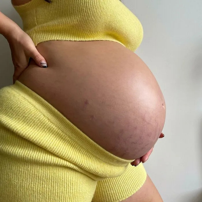 25 Madres comparten fotos realistas de sus barrigas y cuerpos de embarazada para luchar contra los estándares tóxicos
