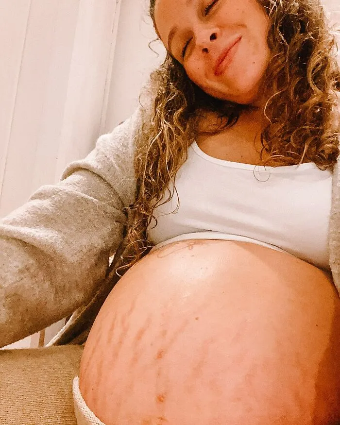 25 Madres comparten fotos realistas de sus barrigas y cuerpos de embarazada para luchar contra los estándares tóxicos