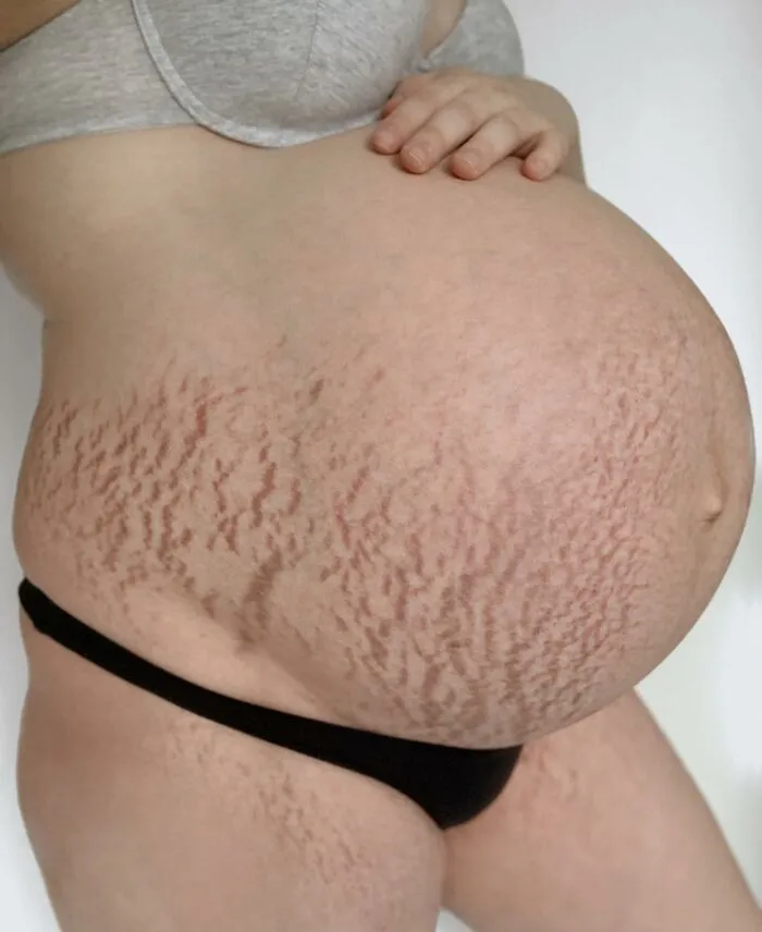 25 Madres comparten fotos realistas de sus barrigas y cuerpos de embarazada para luchar contra los estándares tóxicos